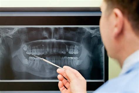 Hidden Dental Costs: X-ray and Exam