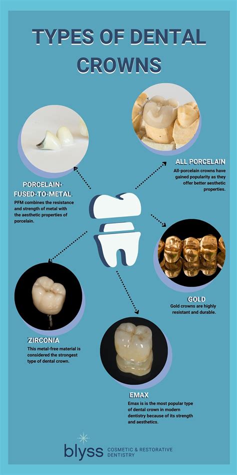Types of Dental Crowns Comparison